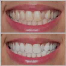 Load image into Gallery viewer, TMLL Teeth Brightening Gel